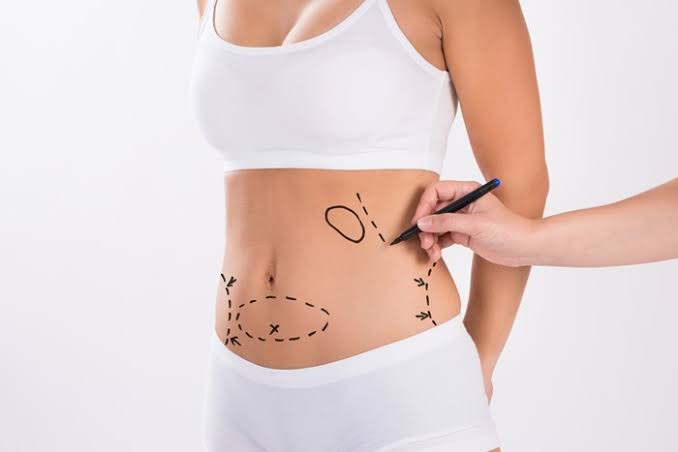 Things to look for Within The Ideal Liposuction Clinic